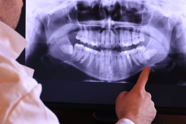 Fast & Reliable Emergency Dental Services in NV
